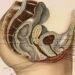 Understanding Obstetrics and Its Role in Pregnancy Complications