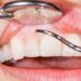 The Smile Revolution: Why Oral Health Is Essential